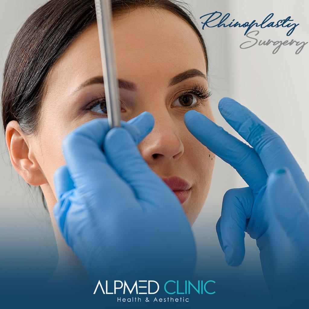 Rhinoplasty